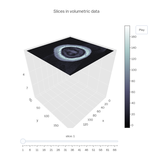 Slices in volumetric data | surface made by Adamkulidjian | plotly