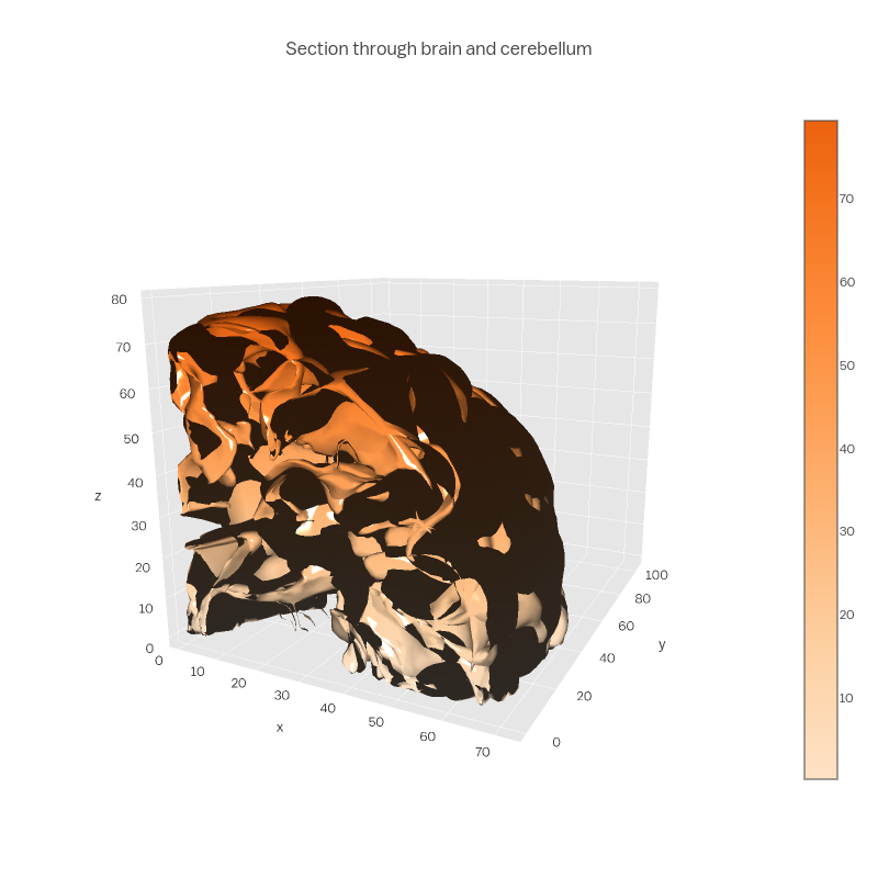 Section through brain and cerebellum | mesh3d made by Empet | plotly