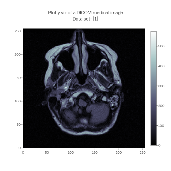 Plotly viz of a DICOM medical imageData set: [1] | heatmap made by Empet | plotly