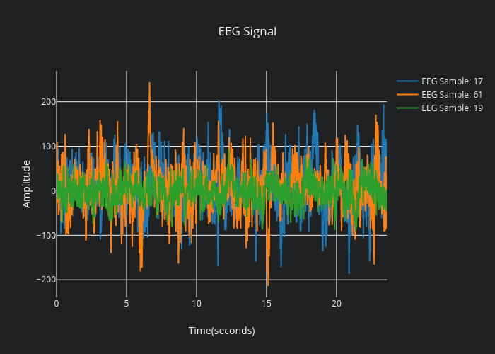 EEG Signal | scatter chart made by Kaancet | plotly
