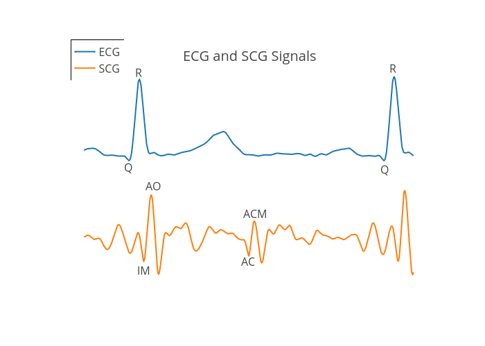 ECG vs SCG | line chart made by Plotenthusiast123 | plotly